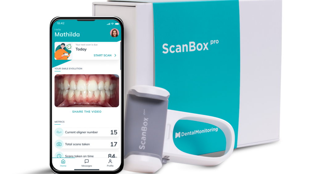 Scanbox Pro met App