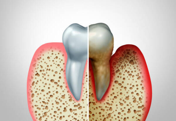 Istockphoto 1181043490 612x612
